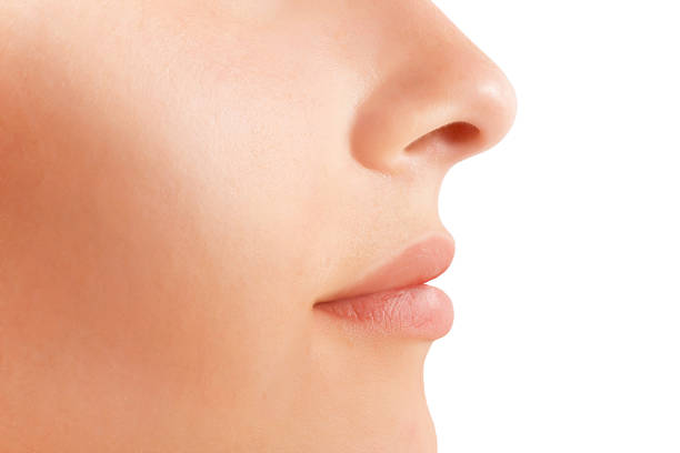 perfect nose - rhinoplasty(nose surgery)