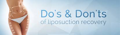 How to Recover Quickly from Liposuction Surgery