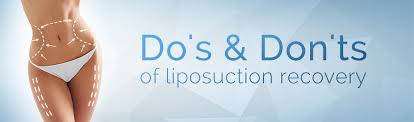 Liposuction