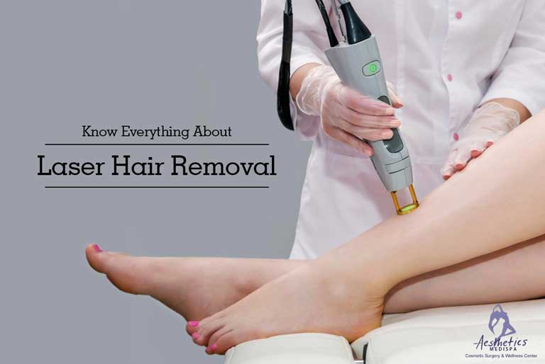 Know Everything About Laser Hair Removal