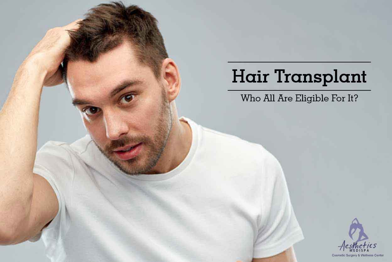 You are currently viewing Hair Transplant – Who All Are Eligible For It?