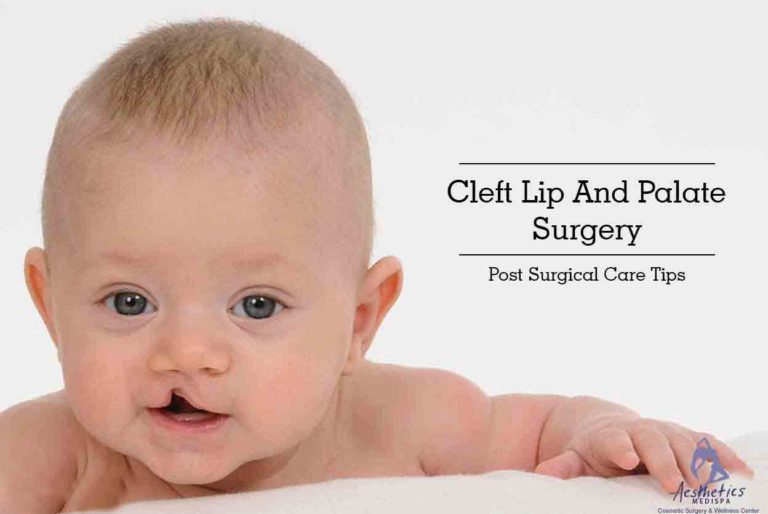 Cleft Lip And Palate Surgery Post Surgical Care Tips