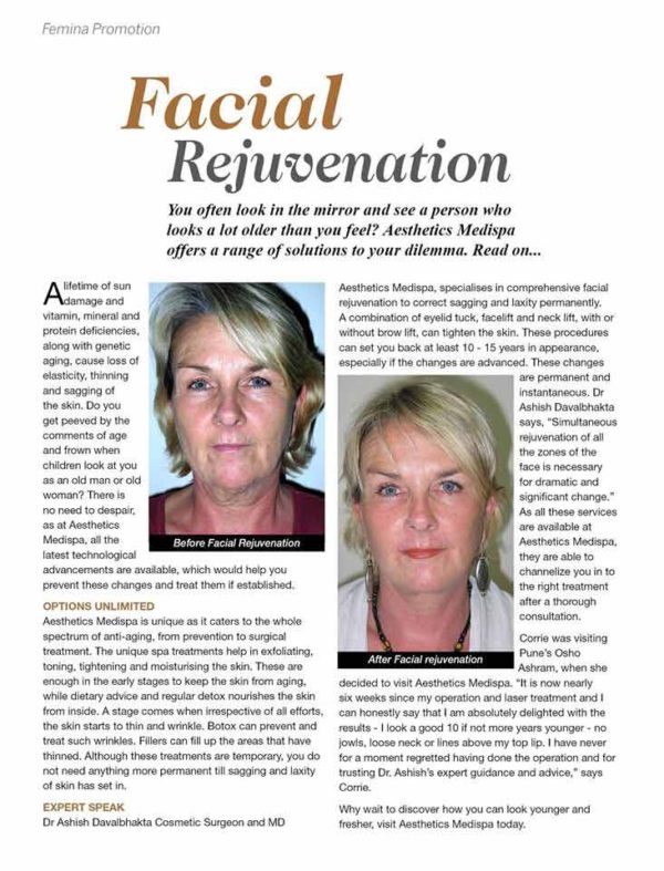 Facial Rejuvenation News Article
