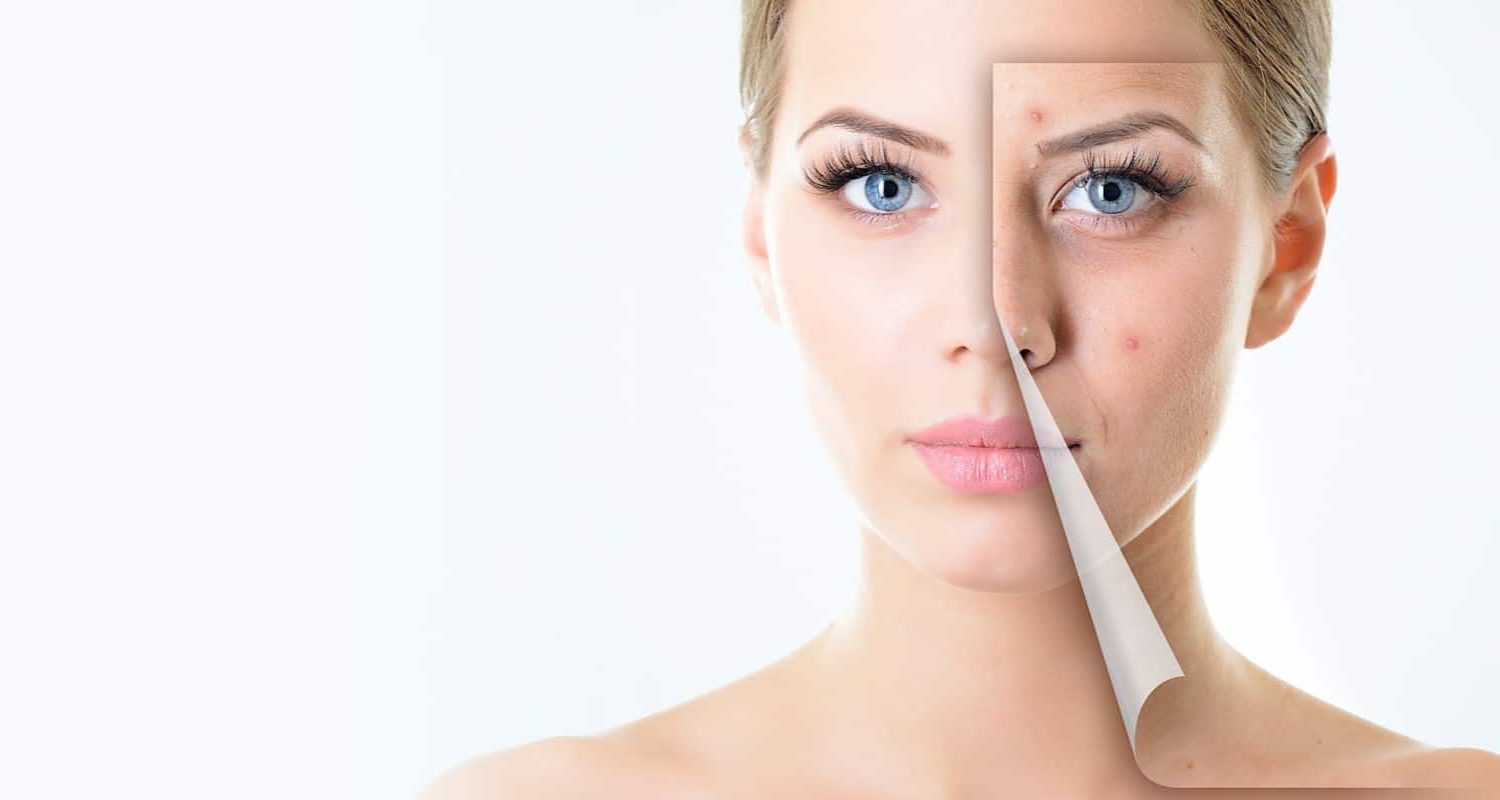 Effective acne and acne scar treatments at Aesthetic Medispa