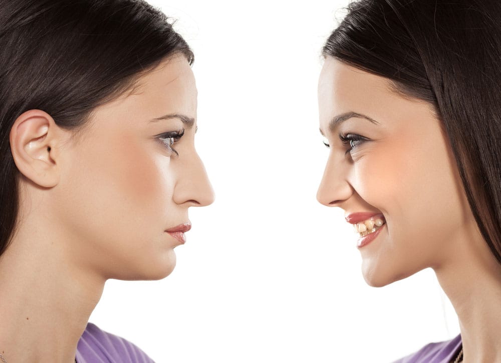 Rhinoplasty Surgery in India – How to decide who’s the best rhinoplasty surgeon for you?