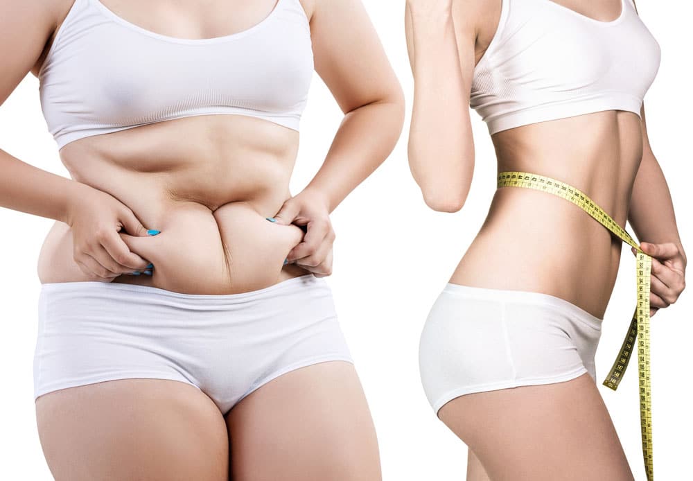 Read more about the article Tummy Tuck Surgery in India: Important Preparation Checklist