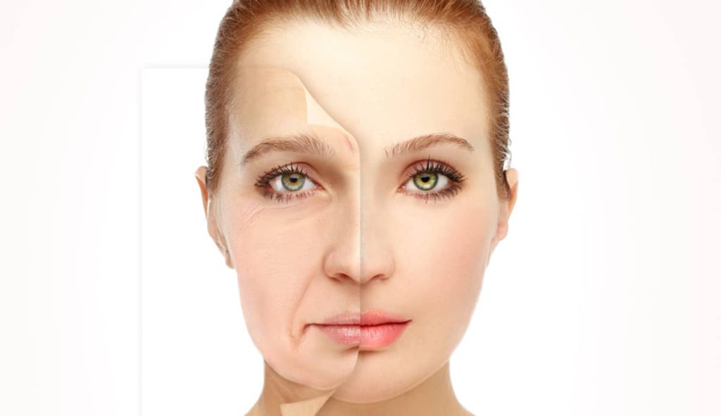 If facelift surgery cost is a concern, consider a mini facelift instead of  a full facelift