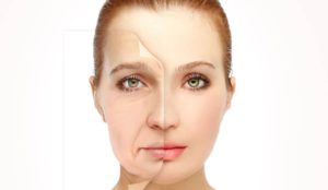 Facelift Surgery in India: Difference between Mini and Full facelift
