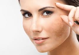 Read more about the article Skin Pigmentation