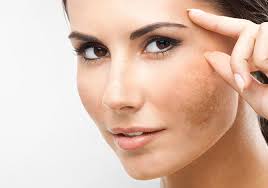 Skin Pigmentation treatment