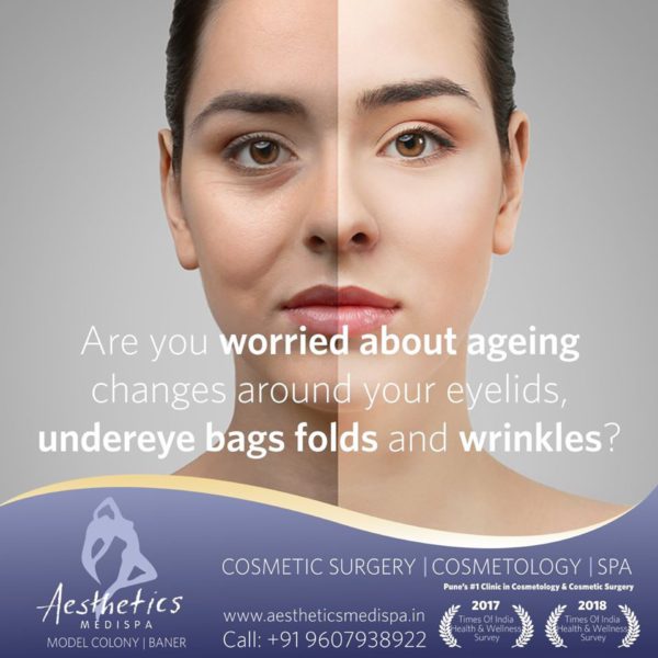 Eyelid surgery (blepharoplasty)
