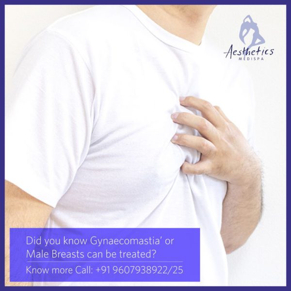Male Breast Surgery (Gynecomastia)