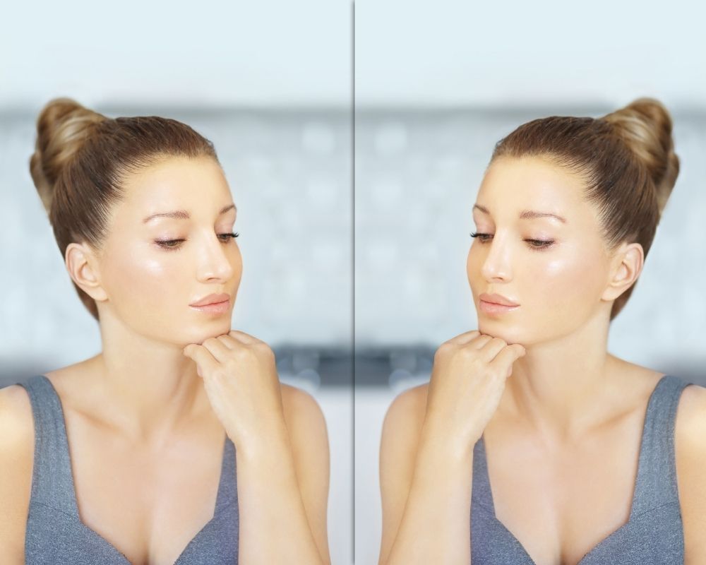 You are currently viewing How Is The Recovery After Rhinoplasty Surgery?