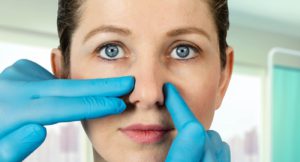 Read more about the article Straightening a Twisted Nose With Rhinoplasty: A Patient Story