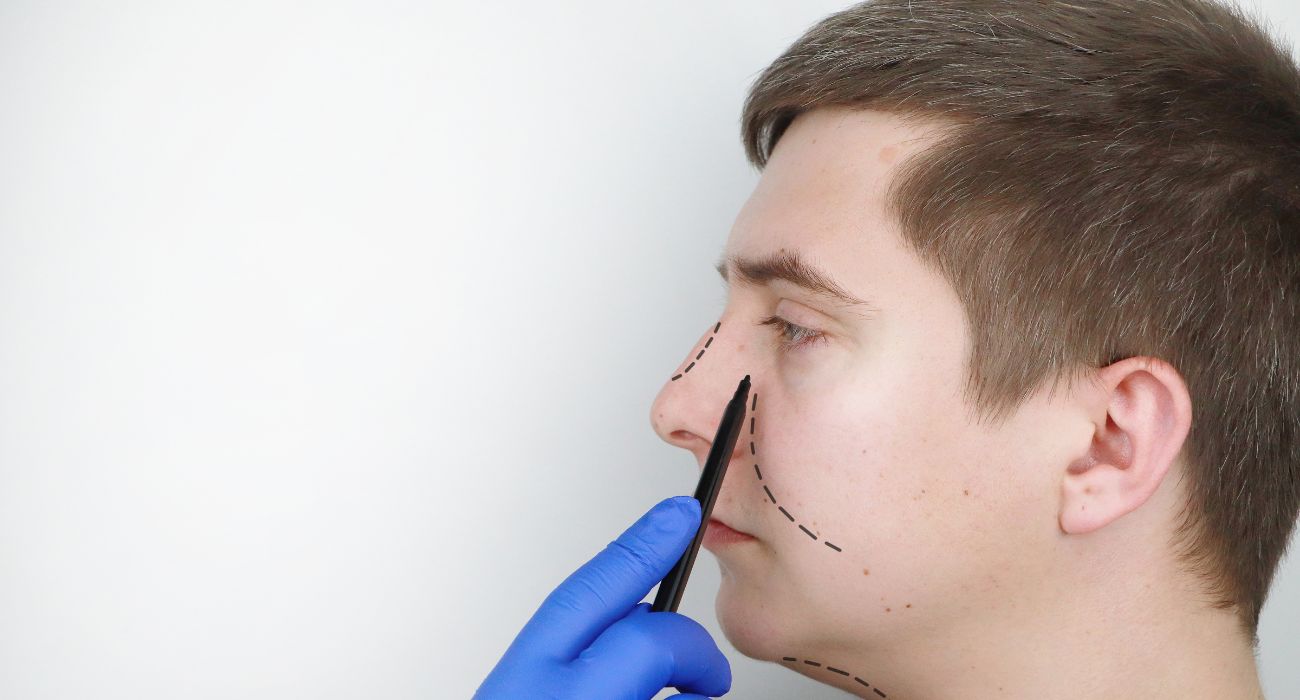 A Young Lad’s Experience with Septoplasty